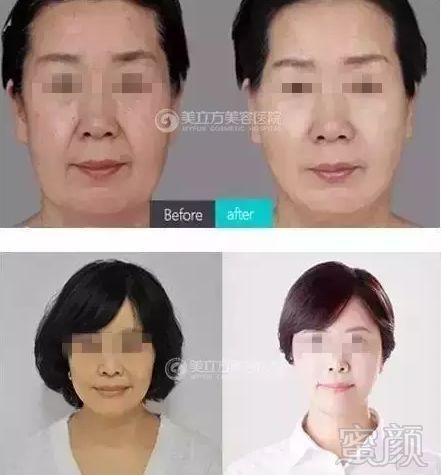 https://img.miyanlife.com/mnt/timg/180128/15495S551-8.jpg