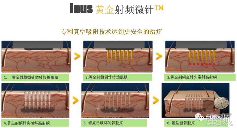 https://img.miyanlife.com/mnt/timg/180128/1600133H9-5.jpg