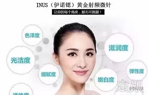https://img.miyanlife.com/mnt/timg/180128/160014N33-7.jpg