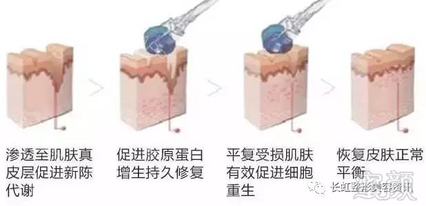 https://img.miyanlife.com/mnt/timg/180128/1600423036-6.jpg