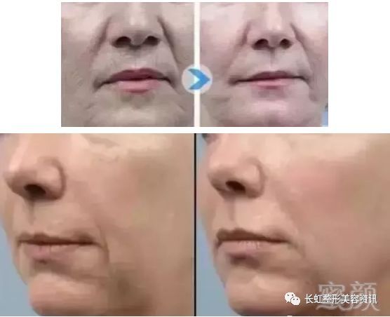 https://img.miyanlife.com/mnt/timg/180128/1600423I6-9.jpg