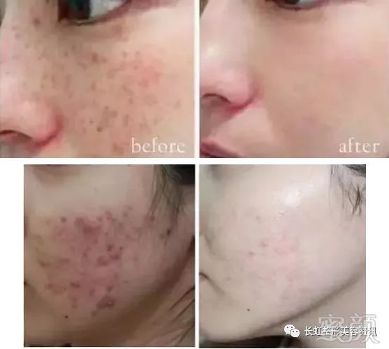 https://img.miyanlife.com/mnt/timg/180128/1600425437-10.jpg