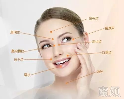 https://img.miyanlife.com/mnt/timg/180129/11013C456-5.jpg