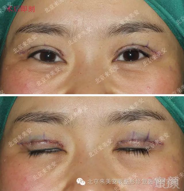 https://img.miyanlife.com/mnt/timg/180129/1111414213-1.jpg