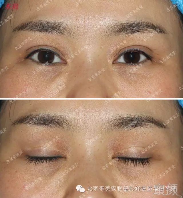 https://img.miyanlife.com/mnt/timg/180129/111141J45-0.jpg