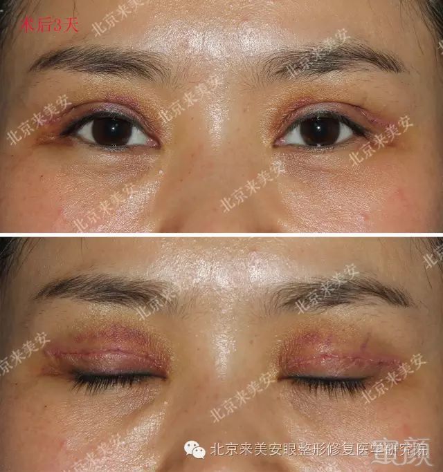 https://img.miyanlife.com/mnt/timg/180129/1111423514-2.jpg