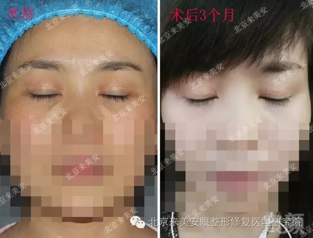https://img.miyanlife.com/mnt/timg/180129/11114311H-6.jpg