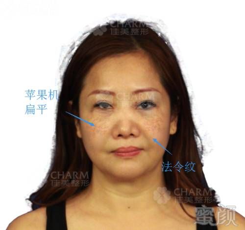 https://img.miyanlife.com/mnt/timg/180129/114A1N39-1.jpg
