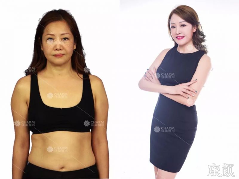 https://img.miyanlife.com/mnt/timg/180129/114A21E4-2.jpg