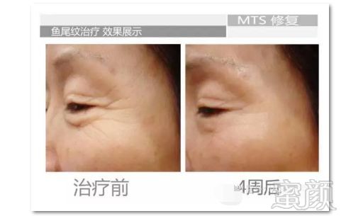 https://img.miyanlife.com/mnt/timg/180129/11503a161-8.jpg
