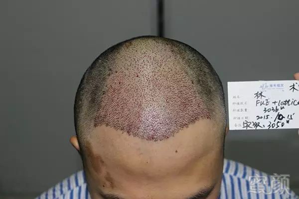 https://img.miyanlife.com/mnt/timg/180129/1153294335-9.jpg