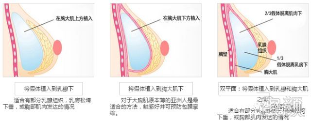 案例图片