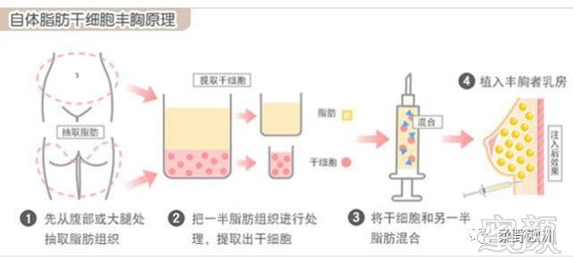 案例图片