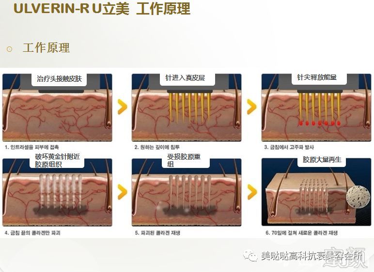 https://img.miyanlife.com/mnt/timg/180130/10494MI9-1.jpg
