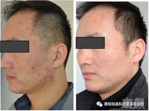 https://img.miyanlife.com/mnt/timg/180130/10494S017-3.jpg