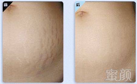 https://img.miyanlife.com/mnt/timg/180130/10503S357-11.jpg