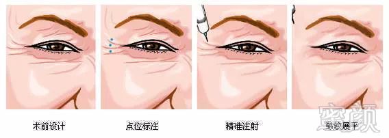 https://img.miyanlife.com/mnt/timg/180130/110134I50-0.jpg