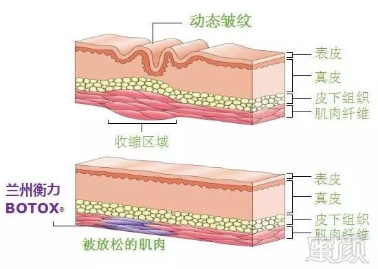 案例图片