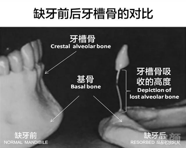 https://img.miyanlife.com/mnt/timg/180130/1114151217-2.jpg