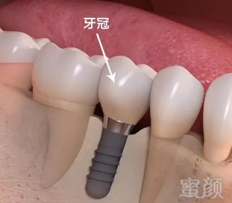 https://img.miyanlife.com/mnt/timg/180130/1114163254-5.jpg