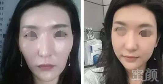 https://img.miyanlife.com/mnt/timg/180130/1126013T8-7.jpg
