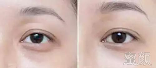 https://img.miyanlife.com/mnt/timg/180130/1126013W8-9.jpg