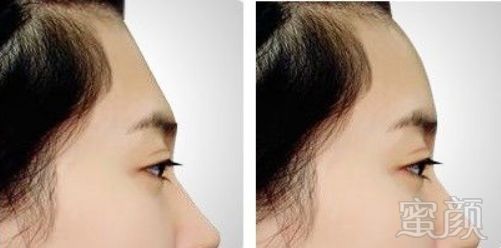 https://img.miyanlife.com/mnt/timg/180130/1126023043-12.jpg