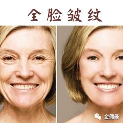 https://img.miyanlife.com/mnt/timg/180130/1130491504-9.jpg