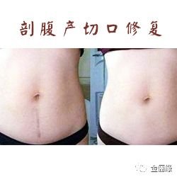 https://img.miyanlife.com/mnt/timg/180130/11304Q504-2.jpg