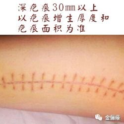 https://img.miyanlife.com/mnt/timg/180130/11304R416-3.jpg