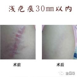 https://img.miyanlife.com/mnt/timg/180130/11304R510-4.jpg