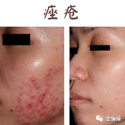 https://img.miyanlife.com/mnt/timg/180130/11304R921-6.jpg