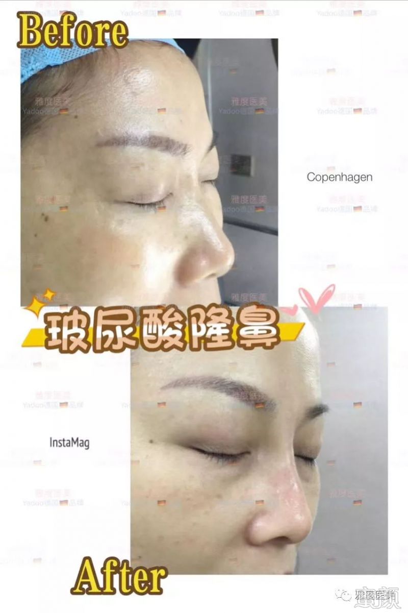 https://img.miyanlife.com/mnt/timg/180130/12112350B-5.jpg
