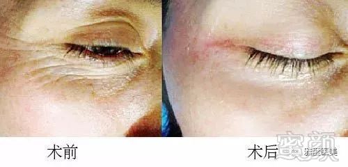 https://img.miyanlife.com/mnt/timg/180130/1211253961-11.jpg