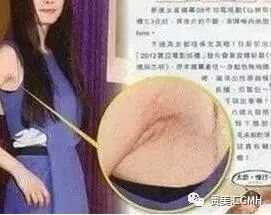 https://img.miyanlife.com/mnt/timg/180130/1222251M8-1.jpg