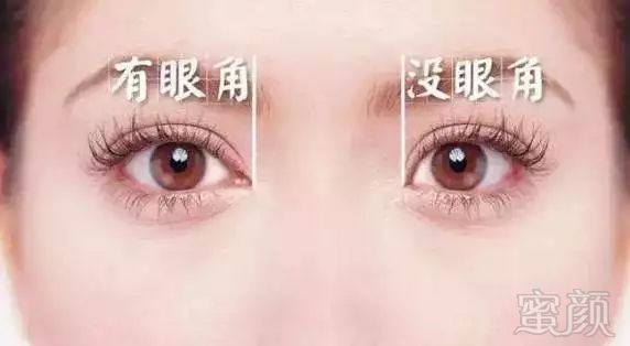 https://img.miyanlife.com/mnt/timg/180130/1235092H9-1.jpg
