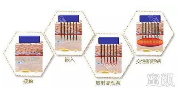 https://img.miyanlife.com/mnt/timg/180130/1253453018-8.jpg