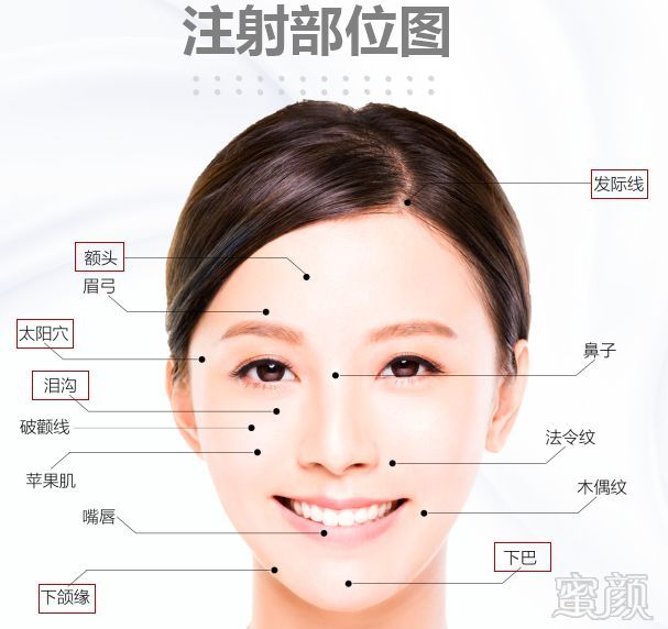 https://img.miyanlife.com/mnt/timg/180131/102J44291-9.jpg