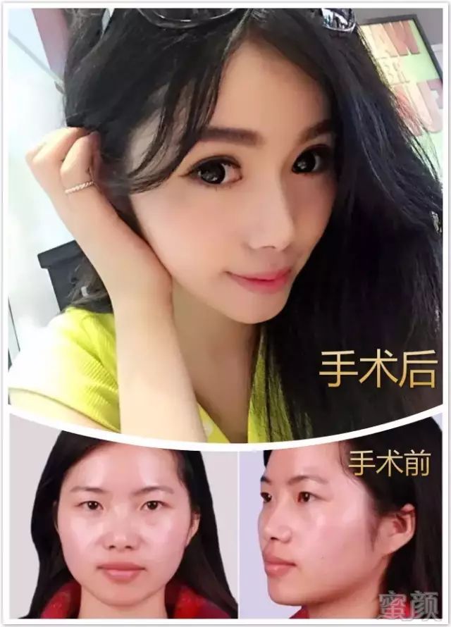 https://img.miyanlife.com/mnt/timg/180131/1032322550-5.jpg