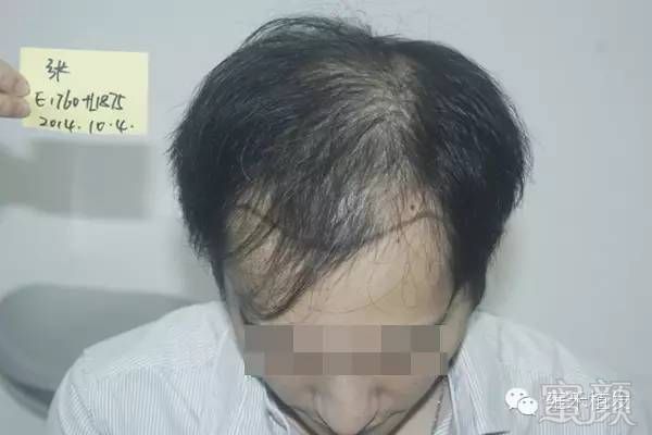 https://img.miyanlife.com/mnt/timg/180131/110Z035O-2.jpg