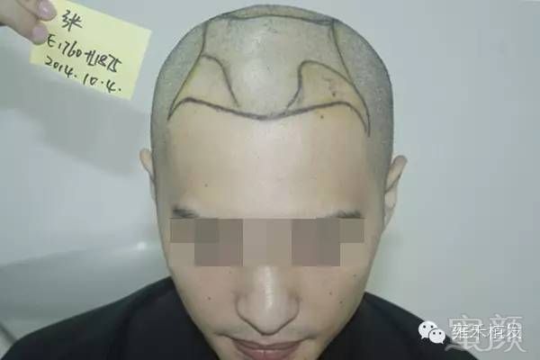 https://img.miyanlife.com/mnt/timg/180131/110Z13N8-5.jpg