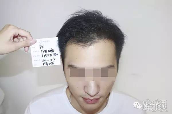 https://img.miyanlife.com/mnt/timg/180131/110Z34394-15.jpg