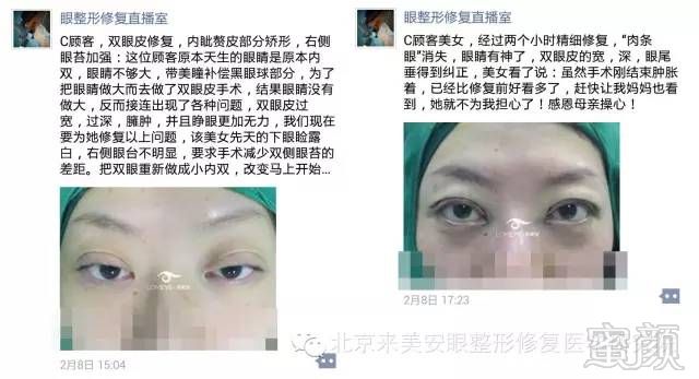 https://img.miyanlife.com/mnt/timg/180131/1114564Q1-1.jpg