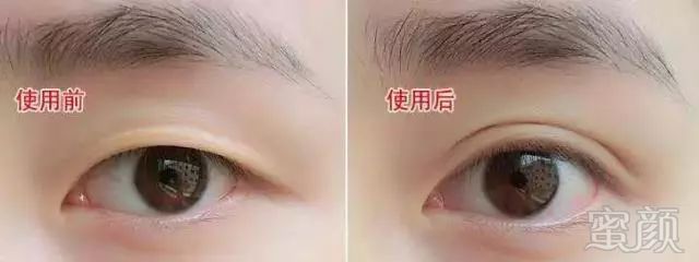 https://img.miyanlife.com/mnt/timg/180131/112335F41-0.jpg