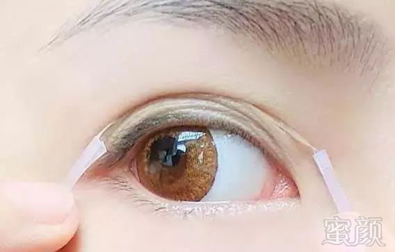 https://img.miyanlife.com/mnt/timg/180131/112335LT-2.jpg