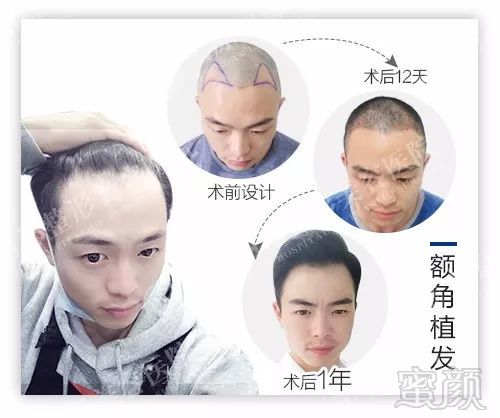 https://img.miyanlife.com/mnt/timg/180131/11255929A-2.jpg