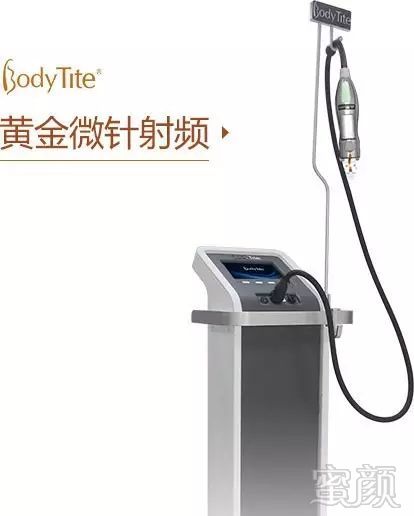 https://img.miyanlife.com/mnt/timg/180131/1145023258-1.jpg
