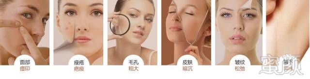 https://img.miyanlife.com/mnt/timg/180131/1145023Z8-0.jpg