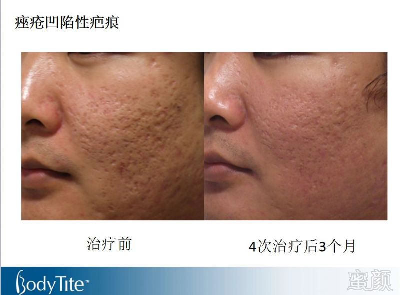 https://img.miyanlife.com/mnt/timg/180131/114502NN-4.jpg