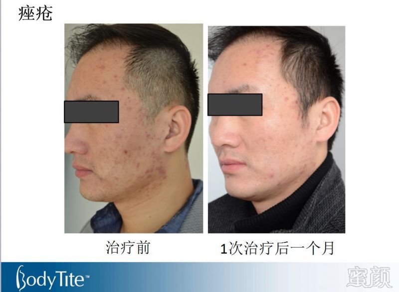 https://img.miyanlife.com/mnt/timg/180131/114503JP-5.jpg